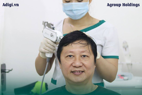 Công nghệ trị hói đầu nam tại Adigi đem lại hiệu quả từ sâu bên trong